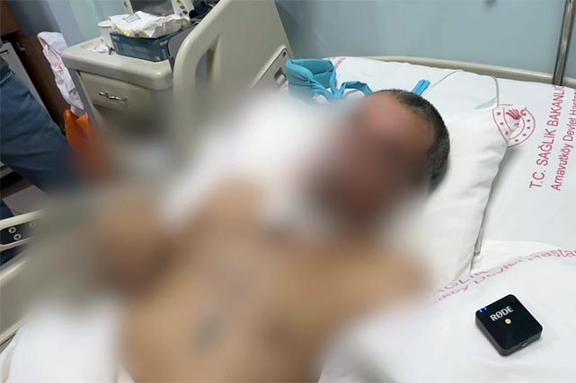 Гражданин Узбекистана в тяжёлом состоянии эвакуирован из Турции при поддержке консульства